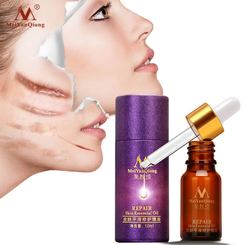 Scar Repair Skin Essential Oil Lavender Essence Skin Care Natural Pure Remove Ance Burn Strentch Marks Scar Removal Treatment
Scar Repair Skin Essential Oil Lavender Essence Skin Care Natural Pure Remove Ance Burn Strentch Marks Scar Removal Treatment