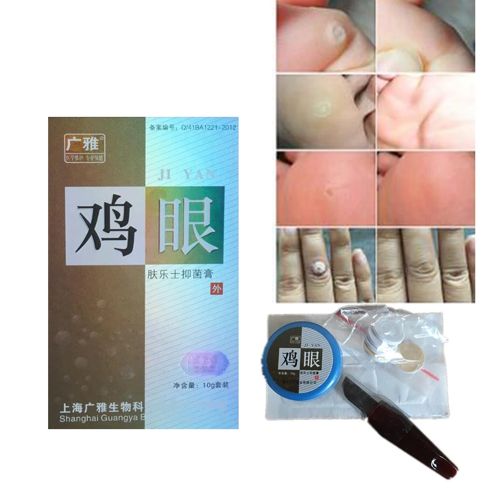 100% Effective Skin Tag Remover Natural Health Mole Nevus Wart Skin Tag Removal Foot Corn Warts Treatment Real Skin Demo D153
100% Effective Skin Tag Remover Natural Health Mole Nevus Wart Skin Tag Removal Foot Corn Warts Treatment Real Skin Demo D153
