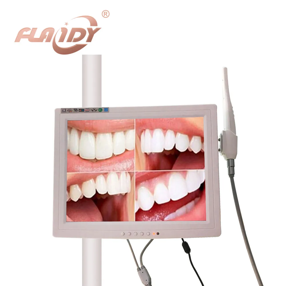 A0003 with a 15 inch monitor VGA Intraoral Camera Endoscope Borescope 6 Led Light Dentist Camera dental camera odontologia
A0003 with a 15 inch monitor VGA Intraoral Camera Endoscope Borescope 6 Led Light Dentist Camera dental camera odontologia