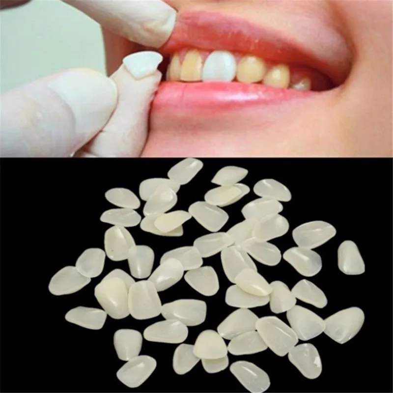 70pcs/pack New Fashion Teeth Care Tools Dental Temporary Crown Ultra Thin Resin Whitening Teeth Anterior Shade Tooth Veneers
70pcs/pack New Fashion Teeth Care Tools Dental Temporary Crown Ultra Thin Resin Whitening Teeth Anterior Shade Tooth Veneers