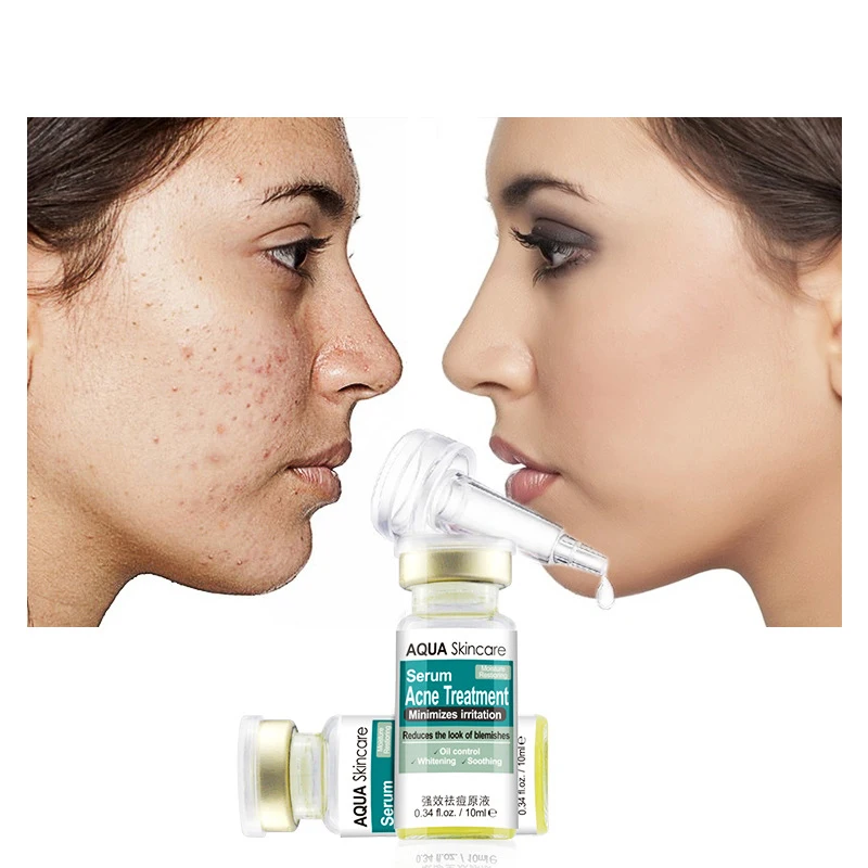 AUQUEST Arrival Herb Acne Treatment Face Serum Effective Detoxification Deeply Nourish Face Skin Care Product 10ml
AUQUEST Arrival Herb Acne Treatment Face Serum Effective Detoxification Deeply Nourish Face Skin Care Product 10ml