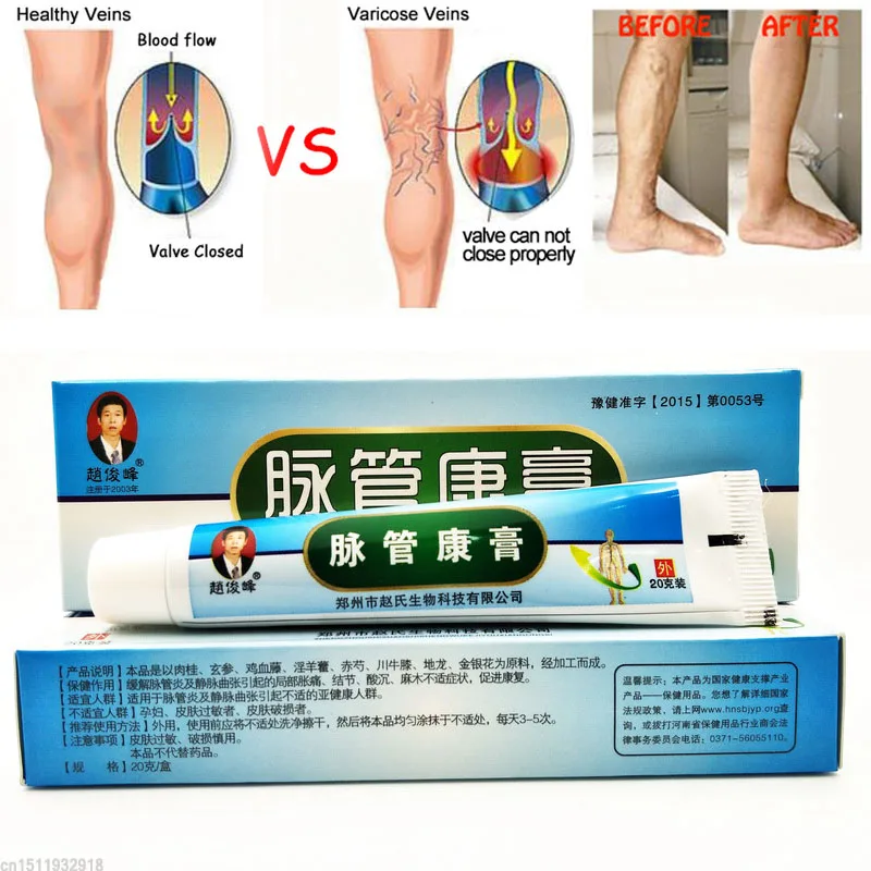 1PC Varicose Veins Treatment Cream Vasculitis Relief Phlebitis Angiitis Inflammation Blood Vessel Legs Varicose Veins Ointment
1PC Varicose Veins Treatment Cream Vasculitis Relief Phlebitis Angiitis Inflammation Blood Vessel Legs Varicose Veins Ointment