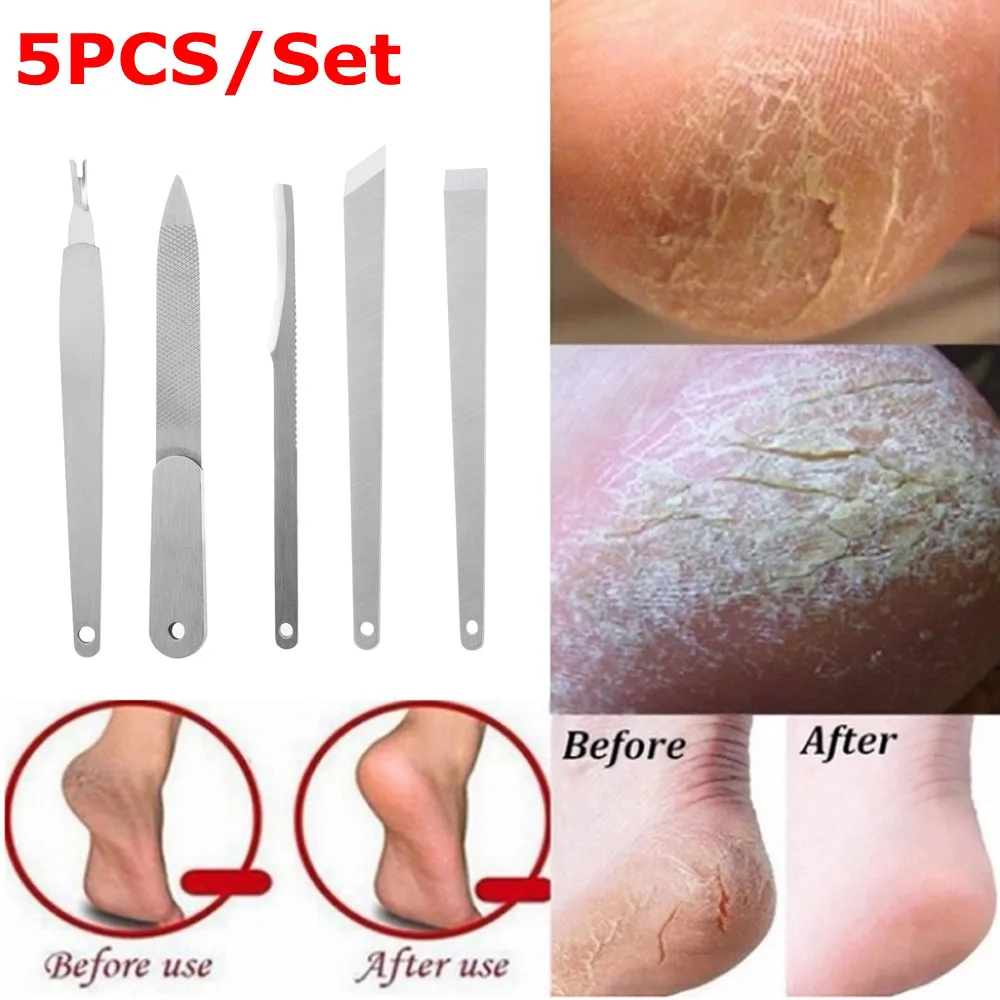 5Pcs Professional Stainless Steel Foot Pedicure Nail File Rasp Metal Silver Finger Toe Cuticle Callus Remover Dead Skin Removal
5Pcs Professional Stainless Steel Foot Pedicure Nail File Rasp Metal Silver Finger Toe Cuticle Callus Remover Dead Skin Removal