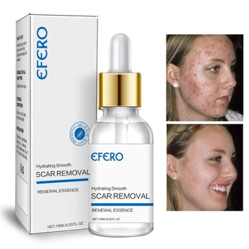 Face Serum for Scar Removal Face Cream Whitening Essence Skin Care Ageless Hyaluronic Acid Acne Treatment
Face Serum for Scar Removal Face Cream Whitening Essence Skin Care Ageless Hyaluronic Acid Acne Treatment