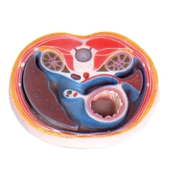 enterocoelia transection model Education demo model for medical observation 29*22.5*5cm free shipping
enterocoelia transection model Education demo model for medical observation 29*22.5*5cm free shipping