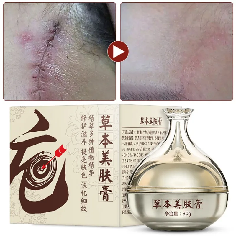 Face Remove Scar Blemish Surgery Scar Treatment Burns Repair Burns Remove Acne Remove Acne Marks Herbal Beauty Cream
Face Remove Scar Blemish Surgery Scar Treatment Burns Repair Burns Remove Acne Remove Acne Marks Herbal Beauty Cream