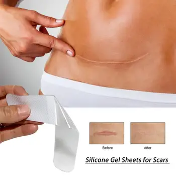 Silicone Gel Sheets For Scars Removal Patch Skin Repair Scar Cover Medical Scar Treatment Prevents Keloid Hypertrophic Scarring
Silicone Gel Sheets For Scars Removal Patch Skin Repair Scar Cover Medical Scar Treatment Prevents Keloid Hypertrophic Scarring