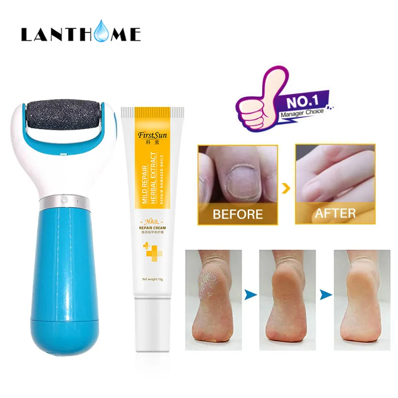 Foot Care Sandpaper Foot File Heel Grater for The Feet Pedicure Rasp Remover Nail Rasp Feet Scrubber Fungal Nail Treatment Cream
Foot Care Sandpaper Foot File Heel Grater for The Feet Pedicure Rasp Remover Nail Rasp Feet Scrubber Fungal Nail Treatment Cream