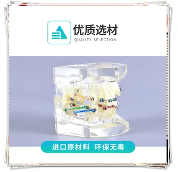 Dental Orthodontic teeth model M3005 with screw/Orthodontic Dental Model Four premolar extracted with brackets
Dental Orthodontic teeth model M3005 with screw/Orthodontic Dental Model Four premolar extracted with brackets