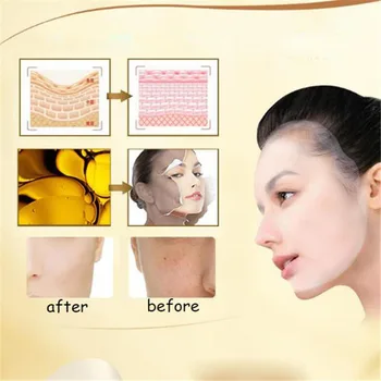 Snail Moisturizing Mask Skin Care Face Brightening Whitening Mask Skin Care MH88
Snail Moisturizing Mask Skin Care Face Brightening Whitening Mask Skin Care MH88