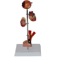 diabetes target organ foot heart kidney model free shipping
diabetes target organ foot heart kidney model free shipping