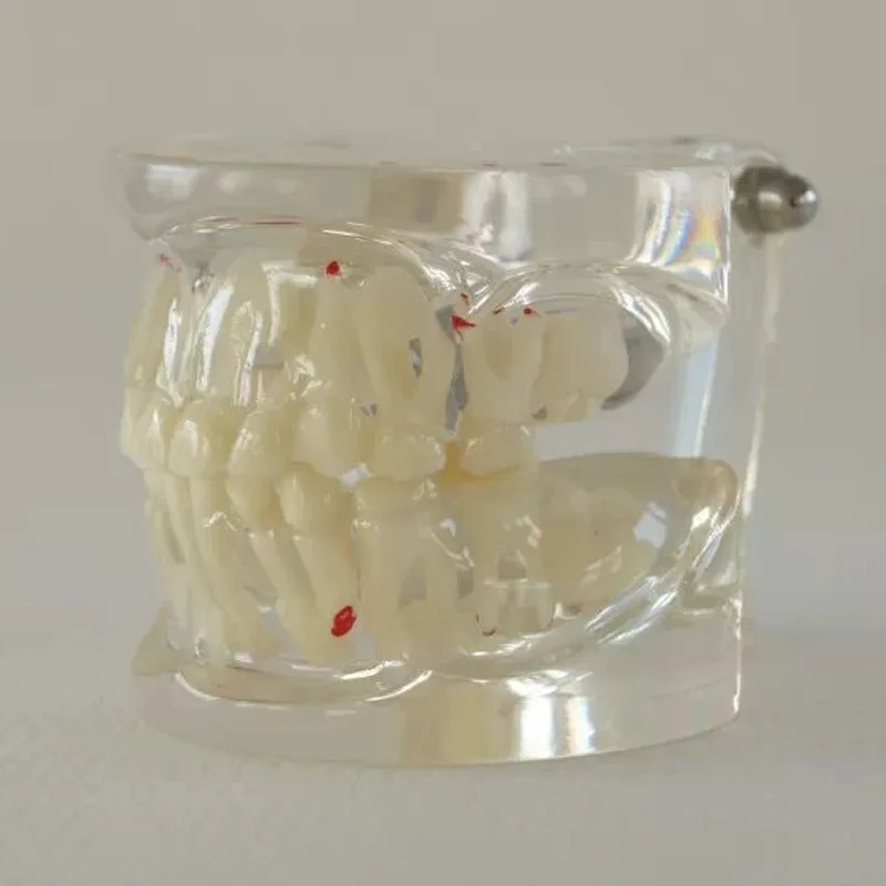 Clear Mixed Age with Pathology Oral Tooth milk permanent teeth alternating Dental Teeth Model
Clear Mixed Age with Pathology Oral Tooth milk permanent teeth alternating Dental Teeth Model