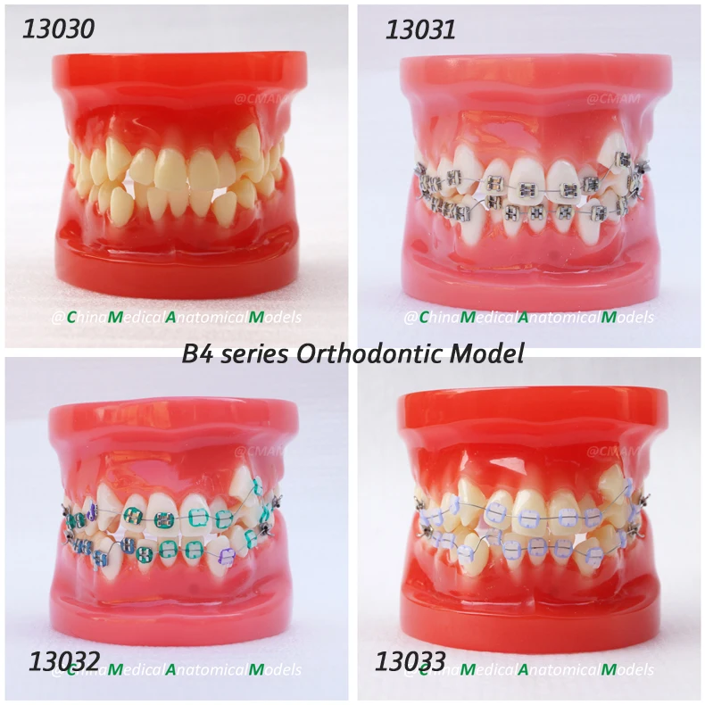 DH/13030, Orthodontic Model, 28 tooth, Dentist Training Oral Dental Orthodontic Model, China Medical Anatomical Model
DH/13030, Orthodontic Model, 28 tooth, Dentist Training Oral Dental Orthodontic Model, China Medical Anatomical Model