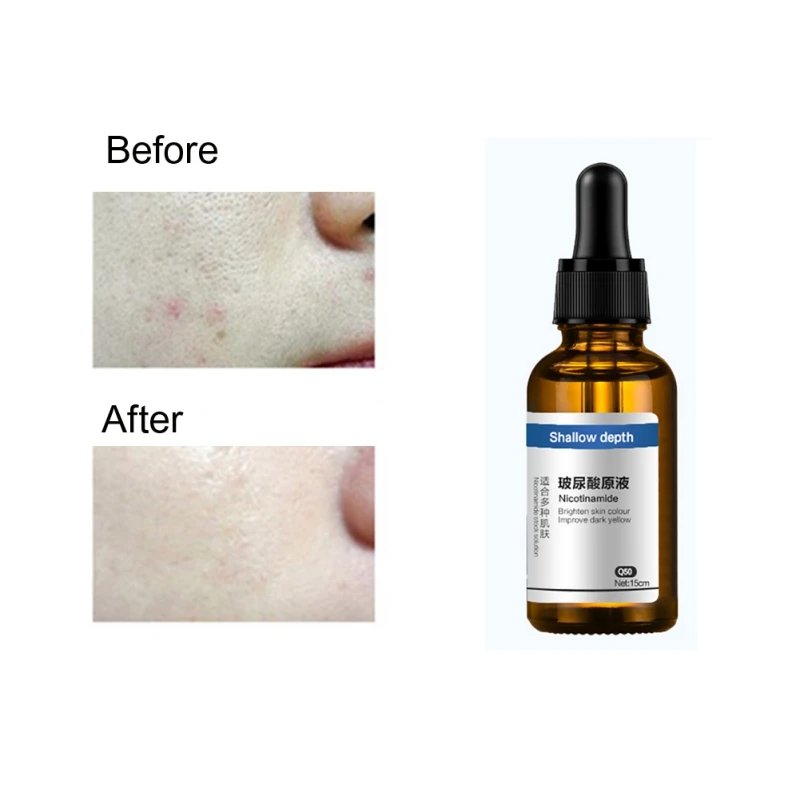 15ml Hyaluronic acid Oligopeptide vitamin C Essence whitening natural face serum Anti Aging Wrinkles Whitening Long Lasting
15ml Hyaluronic acid Oligopeptide vitamin C Essence whitening natural face serum Anti Aging Wrinkles Whitening Long Lasting