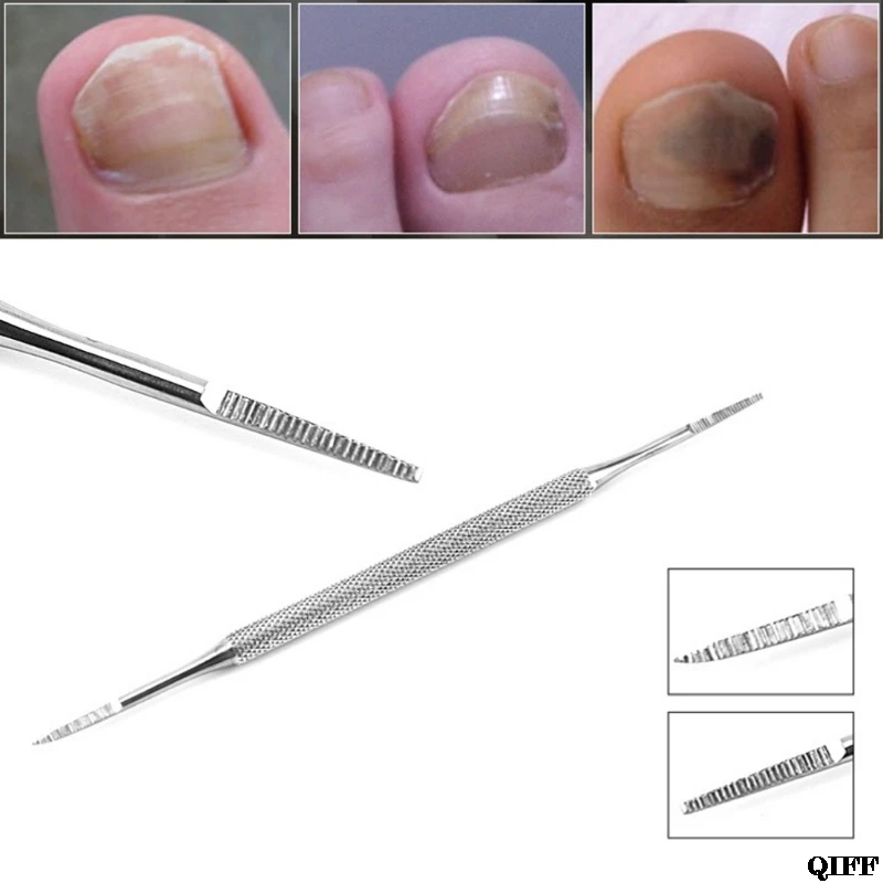 Drop Ship&Wholesale Specially Designed Ingrown Toe Nail Lifter and File Double Ended Sided Pedicure APR28
Drop Ship&Wholesale Specially Designed Ingrown Toe Nail Lifter and File Double Ended Sided Pedicure APR28