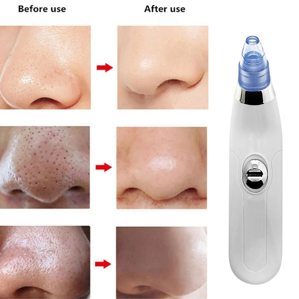 

Profession Vacuum Pore Cleaner Blackhead Remover Electric Acne Clean Exfoliating Cleansing Comedo Suction Facial Beauty Machine