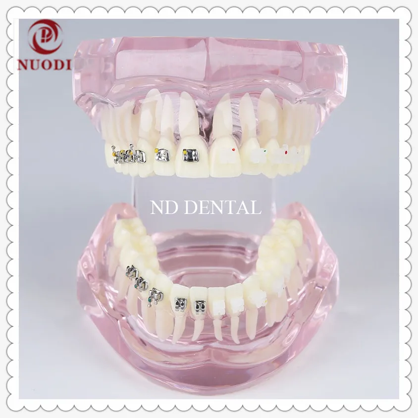 Dental Orthodontic teeth model with ceramic bracket/Dental lab clinic study teeth model with metal bracket/Orthodontic bracket
Dental Orthodontic teeth model with ceramic bracket/Dental lab clinic study teeth model with metal bracket/Orthodontic bracket