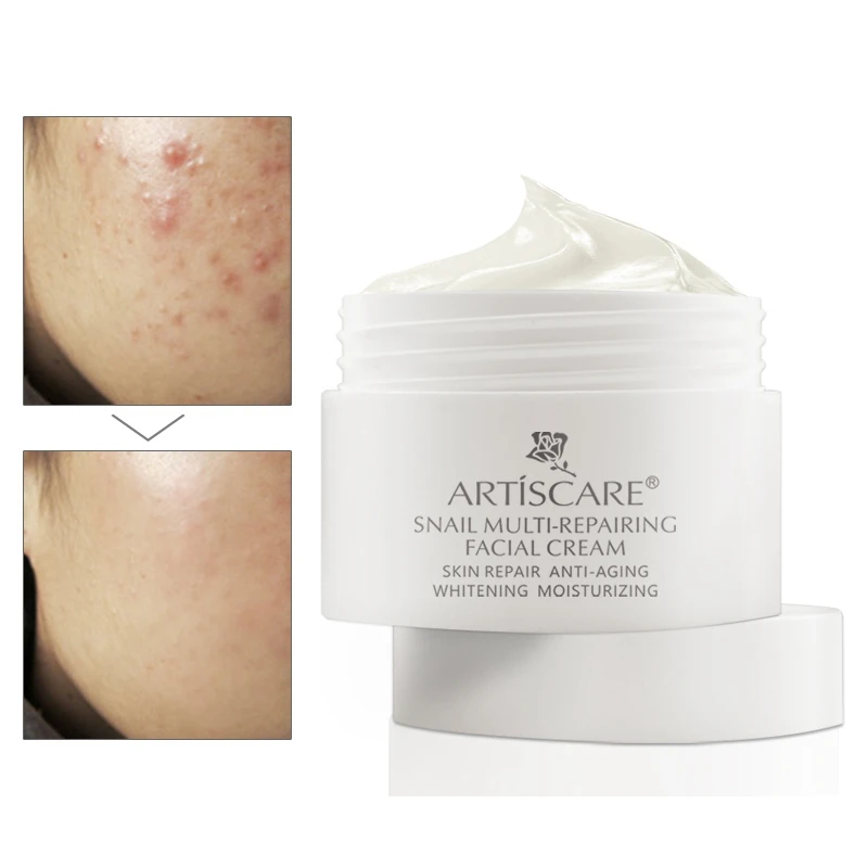 Pure Natural Snail Repair Facial Cream Oil-Control Anti-Wrinkle Acne Moisturizing Lifting Skin Care Easy To Absorb 3003
Pure Natural Snail Repair Facial Cream Oil-Control Anti-Wrinkle Acne Moisturizing Lifting Skin Care Easy To Absorb 3003