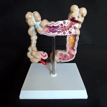 1/2 LifeSize Anatomical Human Colon Pathological Disease Teaching Model Medische Training Huid Esqueleto Humano Anatomia Denture
1/2 LifeSize Anatomical Human Colon Pathological Disease Teaching Model Medische Training Huid Esqueleto Humano Anatomia Denture