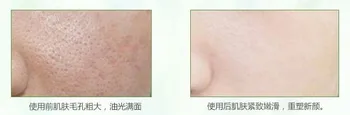 free shipping 1000g lightening brightening Jasmine Essential Oil Lotion skin whitening lotion rapid whitening lotion freckle
free shipping 1000g lightening brightening Jasmine Essential Oil Lotion skin whitening lotion rapid whitening lotion freckle