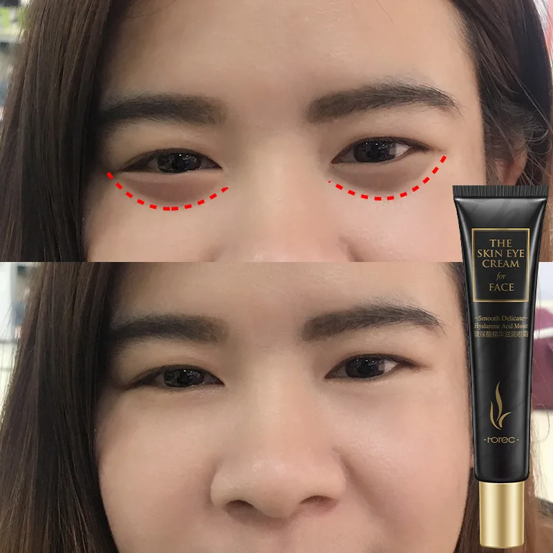 HOREC Hyaluronic Acid Essence Moisturizing Eye Cream Moisturizing to Dark Circles Eye Bag Eye Serum
HOREC Hyaluronic Acid Essence Moisturizing Eye Cream Moisturizing to Dark Circles Eye Bag Eye Serum