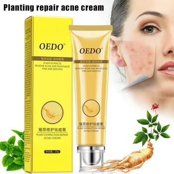 Hot Plant Extraction Repair Acne Cream Moisturizing Oil-Control Shrink Pores Skin Care wyt77
Hot Plant Extraction Repair Acne Cream Moisturizing Oil-Control Shrink Pores Skin Care wyt77