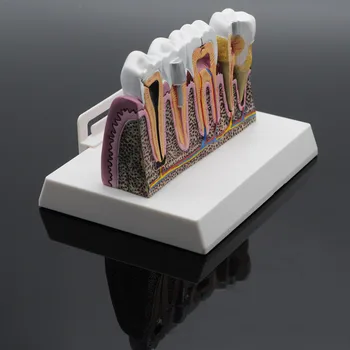 Dental Detachable Caries Demonstration Anatomical Teeth Common Pathologies Model
Dental Detachable Caries Demonstration Anatomical Teeth Common Pathologies Model