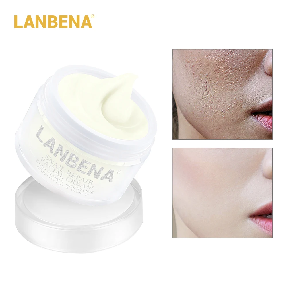 Facial Cream Snail Repair Whitening Day Cream Anti Wrinkle Anti Aging Acne Treatment Moisturizing Firming Skin Care !
Facial Cream Snail Repair Whitening Day Cream Anti Wrinkle Anti Aging Acne Treatment Moisturizing Firming Skin Care !