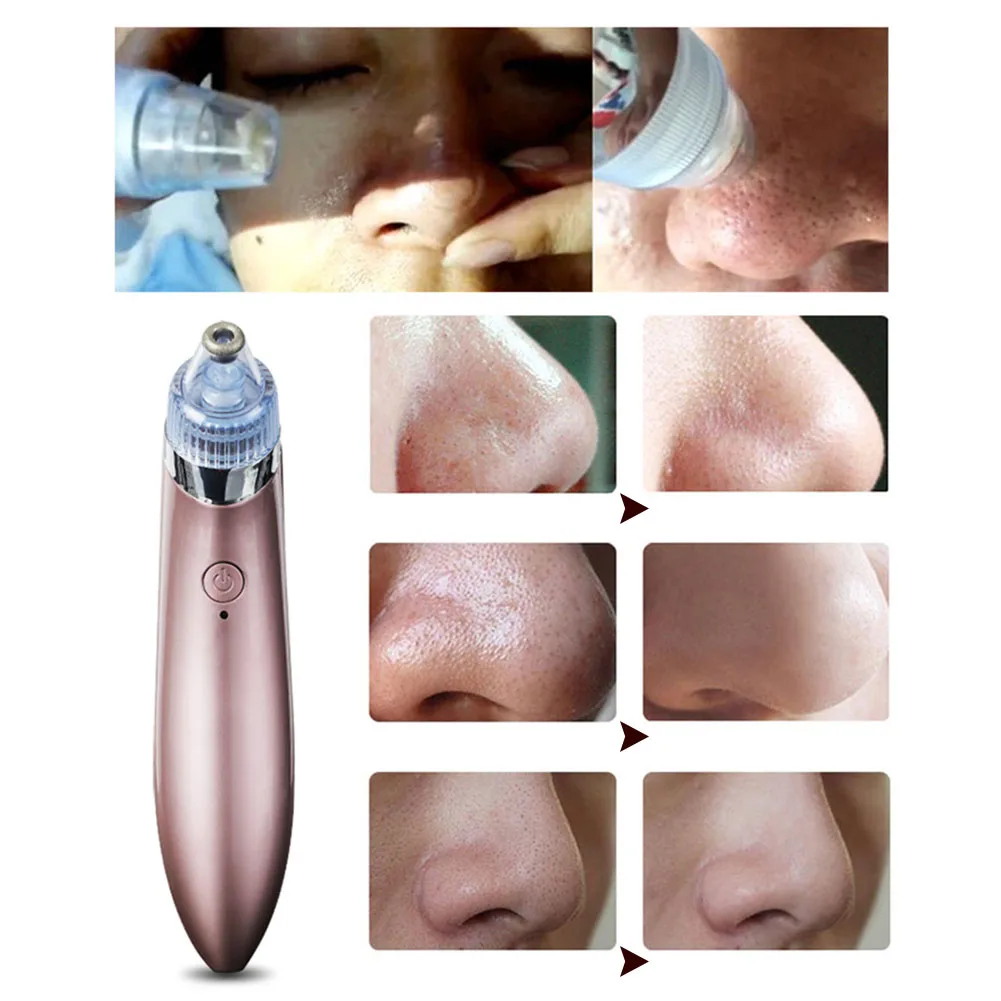 Vacuum Suction Pore Vacuum Cleaner Electric Acne Clean Exfoliating Cleansing Comedo Suction Pore Cleaner
Vacuum Suction Pore Vacuum Cleaner Electric Acne Clean Exfoliating Cleansing Comedo Suction Pore Cleaner