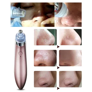 Vacuum Suction Pore Vacuum Cleaner Electric Acne Clean Exfoliating Cleansing Comedo Suction Pore Cleaner
Vacuum Suction Pore Vacuum Cleaner Electric Acne Clean Exfoliating Cleansing Comedo Suction Pore Cleaner