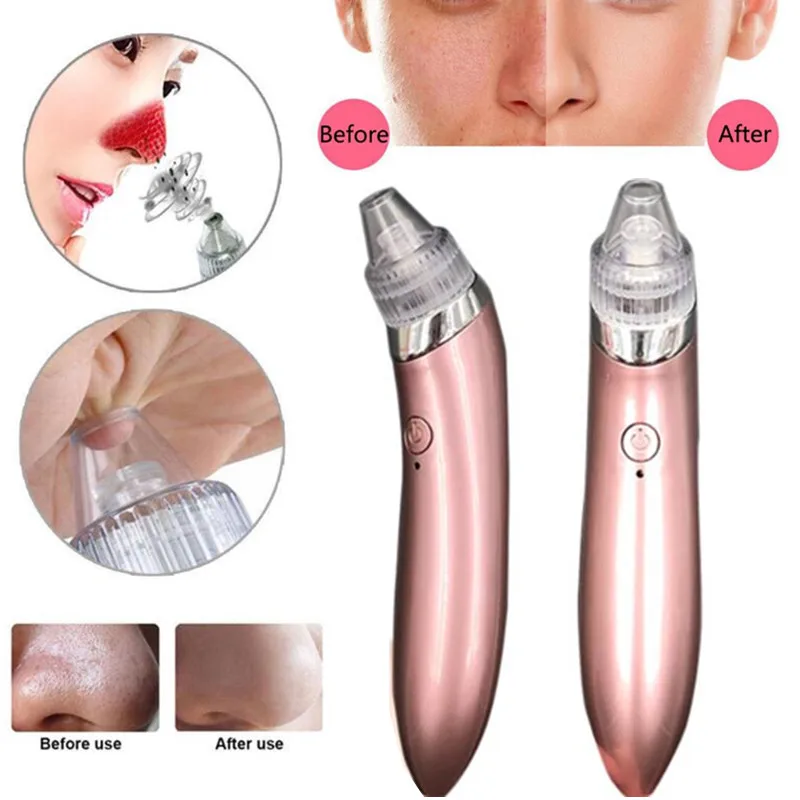 Blackhead Vacuum Electric Pore Cleaner Acne Blackhead Remover Pore Vacuum Extraction USB Rechargeable Comedo Suction Beauty Tool
Blackhead Vacuum Electric Pore Cleaner Acne Blackhead Remover Pore Vacuum Extraction USB Rechargeable Comedo Suction Beauty Tool