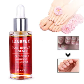 Powerful Anti Infection Paronychia Onychomycosis Fungal Nail Treatment Feet Care Essence Removal Fungus
Powerful Anti Infection Paronychia Onychomycosis Fungal Nail Treatment Feet Care Essence Removal Fungus