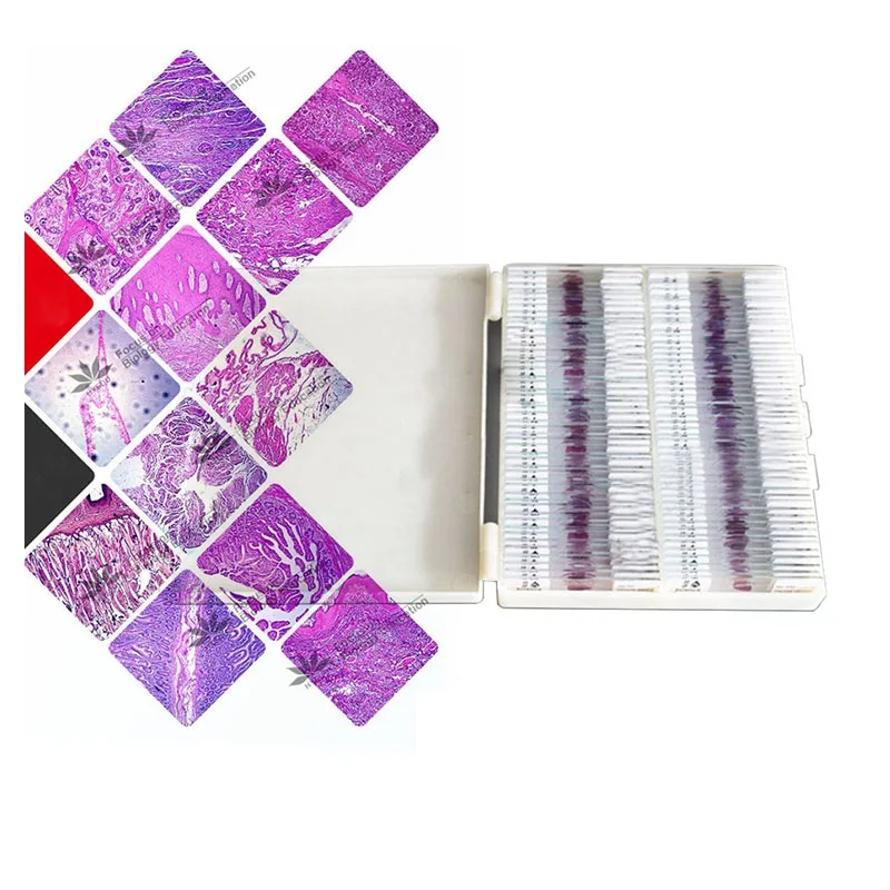 100 PCS Professional Prepared Human Pathology Sections Specimen Microscope Glass Slides for Medical University
100 PCS Professional Prepared Human Pathology Sections Specimen Microscope Glass Slides for Medical University