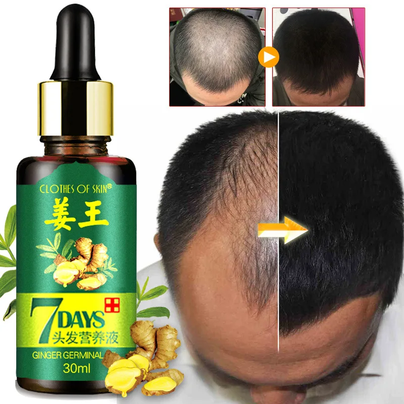 Natural Ginger Oil Anti Hair Loss Treatment Hair Beard Growth Oil Beard Oil Essence Hair Growth Essential Oil Products
Natural Ginger Oil Anti Hair Loss Treatment Hair Beard Growth Oil Beard Oil Essence Hair Growth Essential Oil Products