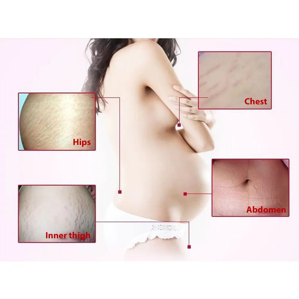 Maternity Skin Repair Cream Postpartum Repair Cream Stretch Mark Repair Cream 100g Skin Care Remove Scar Care Postpartum Useful
Maternity Skin Repair Cream Postpartum Repair Cream Stretch Mark Repair Cream 100g Skin Care Remove Scar Care Postpartum Useful