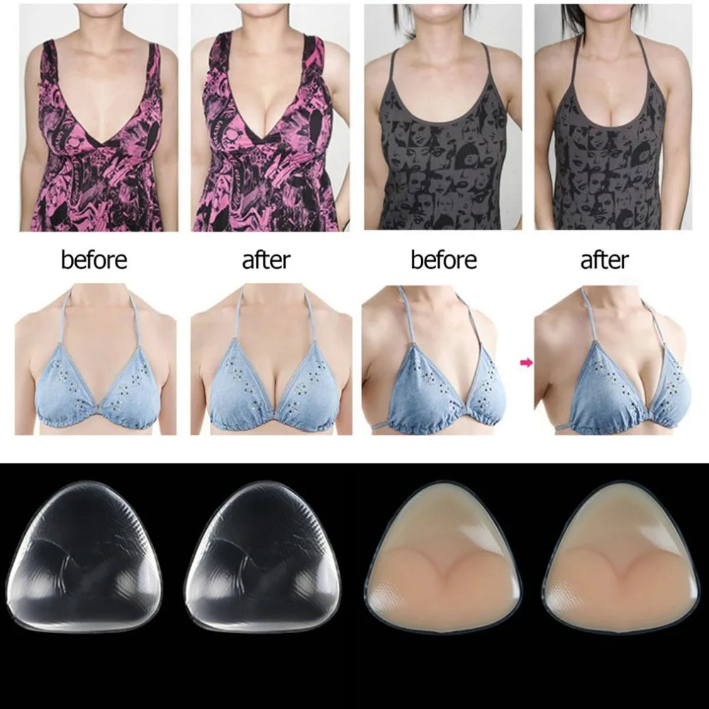 формы женской груди у женщин фото 26