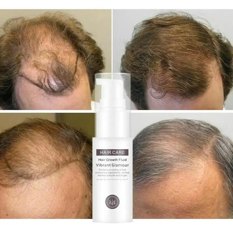 Hair Growth Essence Essential Oil Liquid Spray Nourish Roots Thick Shiny Prevent Hair Loss Anti-hair For Men Women 30ml
Hair Growth Essence Essential Oil Liquid Spray Nourish Roots Thick Shiny Prevent Hair Loss Anti-hair For Men Women 30ml