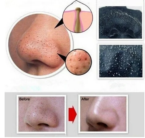 Men Black Mud Deep Cleansing Purifying Peel Of Facail Mask Remove Blackhead Facial Mask Membranes Strips Anti-Wrinkle AgingF6.27
Men Black Mud Deep Cleansing Purifying Peel Of Facail Mask Remove Blackhead Facial Mask Membranes Strips Anti-Wrinkle AgingF6.27