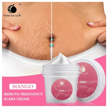 precious Skin Body Cream stretch marks remover scar removal powerful postpartum obesity pregnancy cream
precious Skin Body Cream stretch marks remover scar removal powerful postpartum obesity pregnancy cream