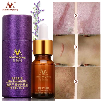 MeiYanQiong Essential Oils Scar Repair Skin Care Smooth Brighten Lavender Oil Essential Pure Oils Natural Bodycare Scar Removal
MeiYanQiong Essential Oils Scar Repair Skin Care Smooth Brighten Lavender Oil Essential Pure Oils Natural Bodycare Scar Removal