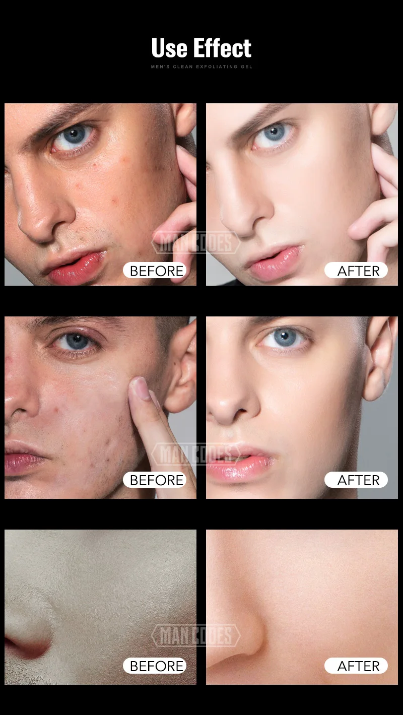 Mencodes Men S Clean Exfoliating Gel Whitening Smooth Skin Peeling Cream Scrub Removal Brightening Moisturize Cream 150g Facial Scrubs Polishes Aliexpress