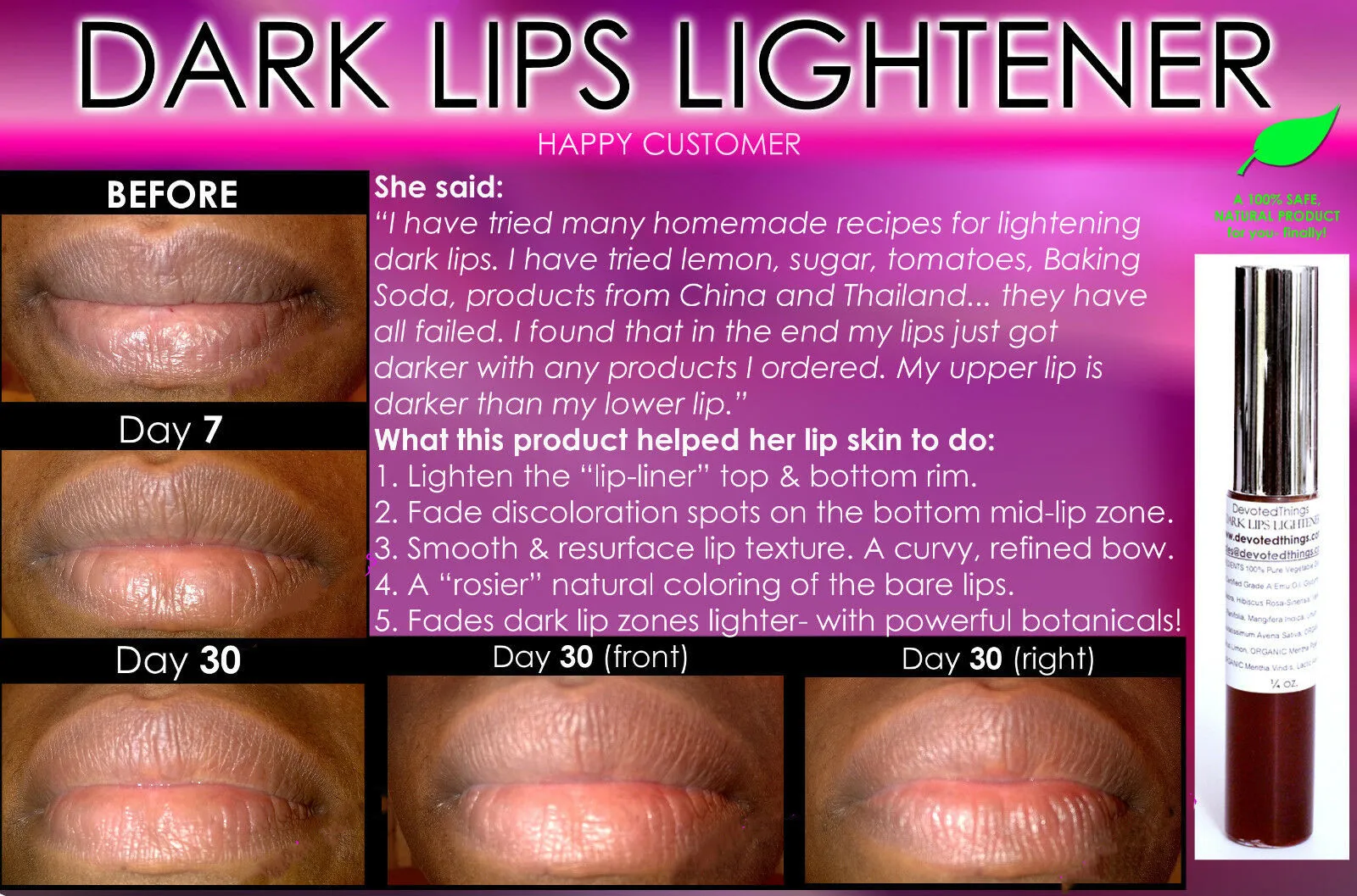 Natural Dark Lip Lightening Product Bleaching Whitening Lips to Pink Smokers too 7.5ml
Natural Dark Lip Lightening Product Bleaching Whitening Lips to Pink Smokers too 7.5ml