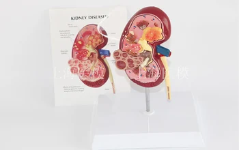 Kidney disease model urology kidney nephron renal glomerulus kidney anatomical model
Kidney disease model urology kidney nephron renal glomerulus kidney anatomical model