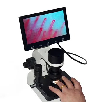 Electronic Microcirculation Detector Peripheral Blood Vessels Observer Digital Microscope with 7"/8" LCD Displayer
Electronic Microcirculation Detector Peripheral Blood Vessels Observer Digital Microscope with 7"/8" LCD Displayer