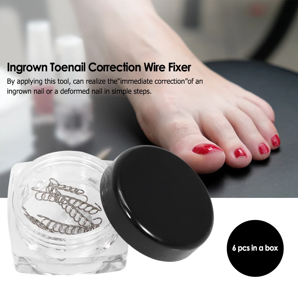 6Pcs/Box Ingrown Toenail Foot Care Correction Wire Fixer Ingrown Toe Corrector Pedicure Treatment Foot Care Tool
6Pcs/Box Ingrown Toenail Foot Care Correction Wire Fixer Ingrown Toe Corrector Pedicure Treatment Foot Care Tool