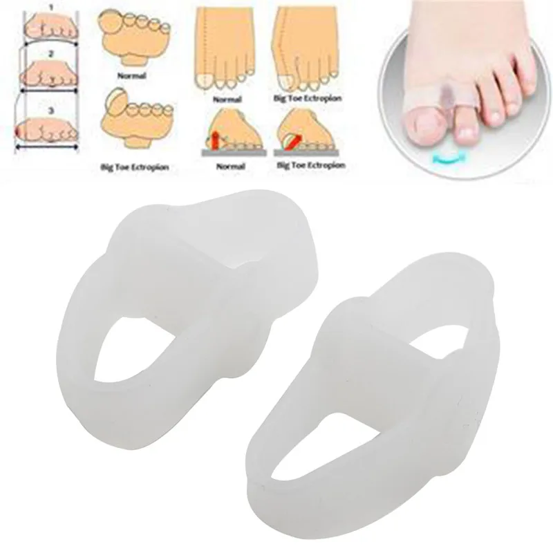 1pc Toe Gel Correction Hallux Valgus Relief Pain Pinkie Thumb Separator Feet Care Bunion Corrector Ingrown Nail Pedicure Tools
1pc Toe Gel Correction Hallux Valgus Relief Pain Pinkie Thumb Separator Feet Care Bunion Corrector Ingrown Nail Pedicure Tools