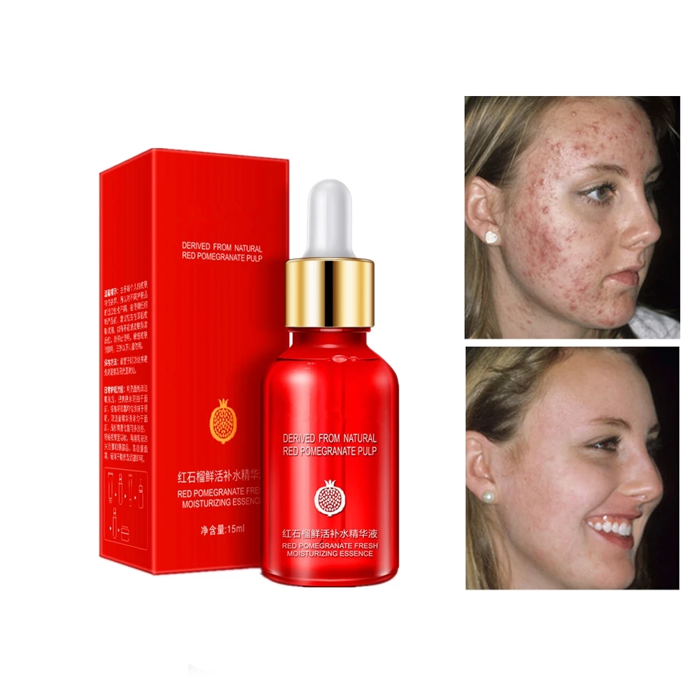 DISAAR 15ml Red Pomegranate Facial Essence Moisturizing Whitening Filling Water Anti Wrinkle Lift Firming Hyaluronic acid
DISAAR 15ml Red Pomegranate Facial Essence Moisturizing Whitening Filling Water Anti Wrinkle Lift Firming Hyaluronic acid