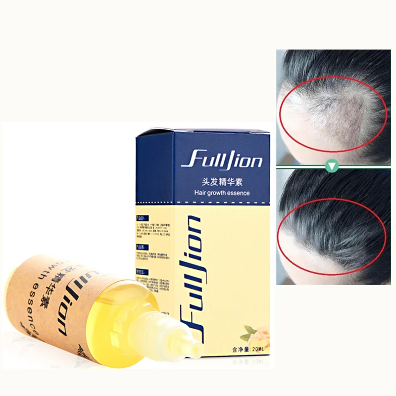 New Anti Hair Loss Treatment Serum Natural Fast Hair Growth Essential Oil Unisex Hair Care Hair Beard Growth Oil 20ml
New Anti Hair Loss Treatment Serum Natural Fast Hair Growth Essential Oil Unisex Hair Care Hair Beard Growth Oil 20ml
