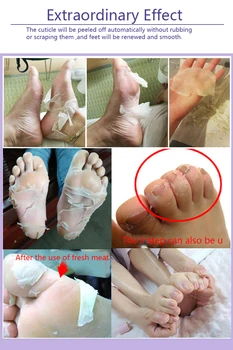 Baby Foot Exfoliating Foot Film Wholesale Repair Skin Hydrating To Remove Pedicure Socks Suede Skin Foot Film Feet Care TSLM1
Baby Foot Exfoliating Foot Film Wholesale Repair Skin Hydrating To Remove Pedicure Socks Suede Skin Foot Film Feet Care TSLM1