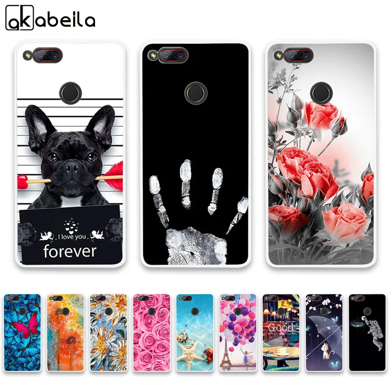 Silicone Phone Cases For Zte Nubia Z17S Case For ZTE Nubia Z17 mini Nubia Z12 mini Covers Flamingo Nutella Fundas Coque Capa
Silicone Phone Cases For Zte Nubia Z17S Case For ZTE Nubia Z17 mini Nubia Z12 mini Covers Flamingo Nutella Fundas Coque Capa